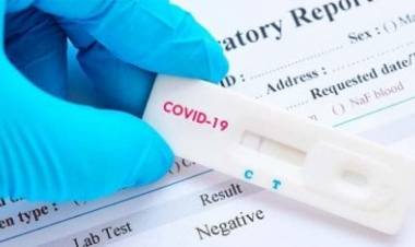 La Anmat autorizó el uso de cuatro test de autoevaluación de Covid-19